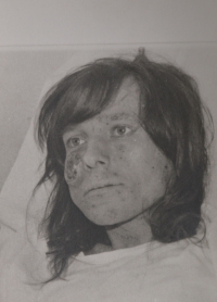 Jiří Legerský, a secret religious from Opava suffering from skin cancer
