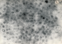 Virové částice po centrifugaci, cca 1966