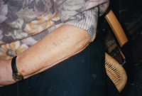 Maminka pamětníka a její vytetované číslo z koncentračního tábora