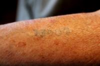 vytetované číslo 73500