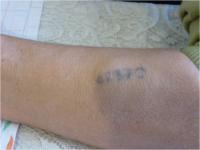 Tatooed number from Auschwitz